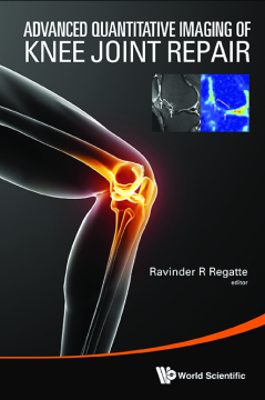 Advanced Quantitative Imaging Of Knee Joint Repair Advanced Quantitative Imaging Of Knee Joint Repair
