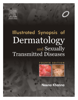 Illustrated Synopsis of Dermatology & Sexually Transmitted Diseases - E-book Illustrated Synopsis of Dermatology & Sexually Transmitted Diseases - E-book