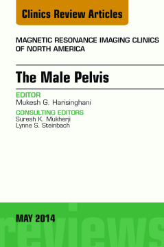 MRI of the Male Pelvis, An Issue of Magnetic Resonance Imaging Clinics of North America, E-Book MRI of the Male Pelvis, An Issue of Magnetic Resonance Imaging Clinics of North America, E-Book