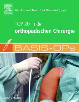 Basis OPs - Top 20 in der orthopädischen Chirurgie Basis OPs - Top 20 in der orthopädischen Chirurgie