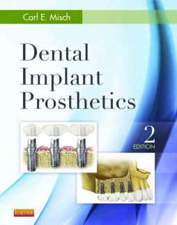 Dental Implant Prosthetics - E-Book Dental Implant Prosthetics - E-Book