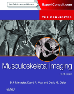 Musculoskeletal Imaging: The Requisites E-Book Musculoskeletal Imaging: The Requisites E-Book