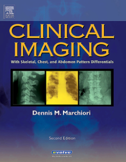 Clinical Imaging - E-Book Clinical Imaging - E-Book