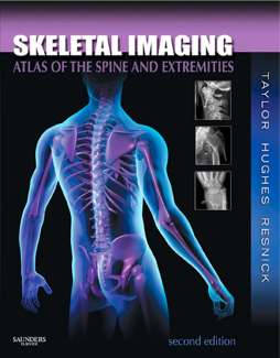 Skeletal Imaging - E-Book Skeletal Imaging - E-Book
