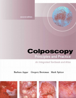 Colposcopy E-Book Colposcopy E-Book