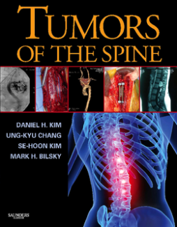 Tumors of the Spine E-Book Tumors of the Spine E-Book