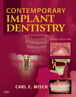 Contemporary Implant Dentistry - E-Book Contemporary Implant Dentistry - E-Book