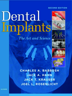Dental Implants - E-Book Dental Implants - E-Book