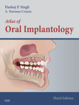 Atlas of Oral Implantology - E-Book Atlas of Oral Implantology - E-Book