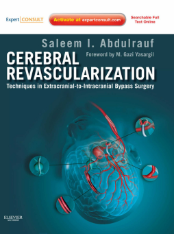 Cerebral Revascularization - E-Book Cerebral Revascularization - E-Book