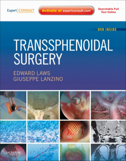 Transsphenoidal Surgery E-Book Transsphenoidal Surgery E-Book
