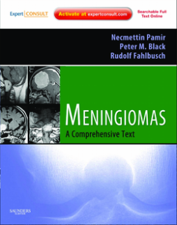 SD - Meningiomas E-Book SD - Meningiomas E-Book