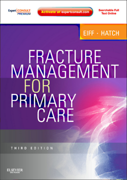 Fracture Management for Primary Care E-Book Fracture Management for Primary Care E-Book