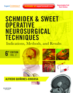 Schmidek and Sweet: Operative Neurosurgical Techniques E-Book Schmidek and Sweet: Operative Neurosurgical Techniques E-Book