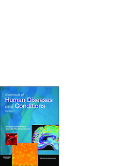 Essentials of Human Diseases and Conditions - E-Book Essentials of Human Diseases and Conditions - E-Book