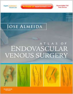 Atlas of Endovascular Venous Surgery E-Book Atlas of Endovascular Venous Surgery E-Book