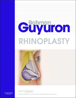 Rhinoplasty E-Book Rhinoplasty E-Book