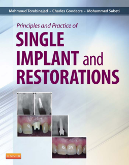 Principles and Practice of Single Implant and Restoration - E-Book Principles and Practice of Single Implant and Restoration - E-Book