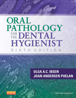 Oral Pathology for the Dental Hygienist - E-Book Oral Pathology for the Dental Hygienist - E-Book