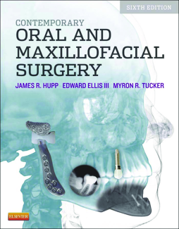 Contemporary Oral and Maxillofacial Surgery - E-Book Contemporary Oral and Maxillofacial Surgery - E-Book