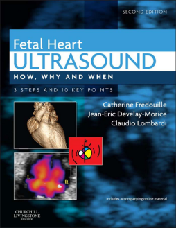 Fetal Heart Ultrasound - E-Book Fetal Heart Ultrasound - E-Book