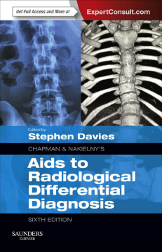 Chapman & Nakielny's Aids to Radiological Differential Diagnosis E-Book Chapman & Nakielny's Aids to Radiological Differential Diagnosis E-Book