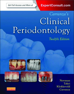 Carranza's Clinical Periodontology - E-Book Carranza's Clinical Periodontology - E-Book