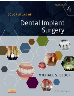 Color Atlas of Dental Implant Surgery - E-Book Color Atlas of Dental Implant Surgery - E-Book