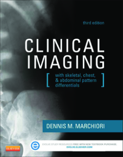 Clinical Imaging - E-Book Clinical Imaging - E-Book