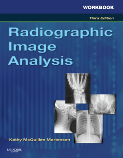 Workbook for Radiographic Image Analysis - E-Book Workbook for Radiographic Image Analysis - E-Book