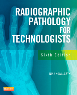 Radiographic Pathology for Technologists - E-Book Radiographic Pathology for Technologists - E-Book