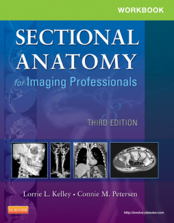 Workbook for Sectional Anatomy for Imaging Professionals - E-Book Workbook for Sectional Anatomy for Imaging Professionals - E-Book