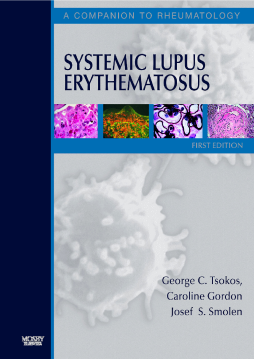 Systemic Lupus Erythematosus E-Book Systemic Lupus Erythematosus E-Book