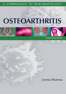 Osteoarthritis E-Book Osteoarthritis E-Book