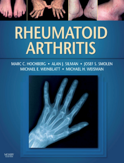 Rheumatoid Arthritis E-Book Rheumatoid Arthritis E-Book