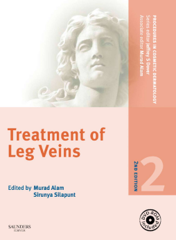 Procedures in Cosmetic Dermatology Series: Treatment of Leg Veins E-Book Procedures in Cosmetic Dermatology Series: Treatment of Leg Veins E-Book