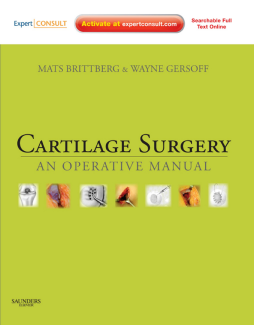 SD - Cartilage Surgery E-Book SD - Cartilage Surgery E-Book