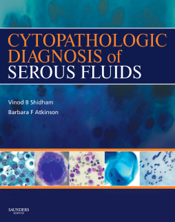 Cytopathologic Diagnosis of Serous Fluids E-Book Cytopathologic Diagnosis of Serous Fluids E-Book