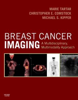 Breast Cancer Imaging E-Book Breast Cancer Imaging E-Book