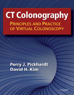 CT Colonography: Principles and Practice of Virtual Colonoscopy E-Book CT Colonography: Principles and Practice of Virtual Colonoscopy E-Book