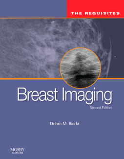 Breast Imaging: The Requisites E-Book Breast Imaging: The Requisites E-Book