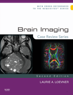 Brain Imaging: Case Review Series E-Book