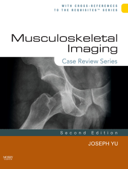 Musculoskeletal Imaging: Case Review Series E-Book Musculoskeletal Imaging: Case Review Series E-Book