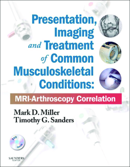 Presentation, Imaging and Treatment of Common Musculoskeletal Conditions E-Book Presentation, Imaging and Treatment of Common Musculoskeletal Conditions E-Book
