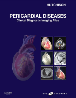 Pericardial Diseases E-Book Pericardial Diseases E-Book