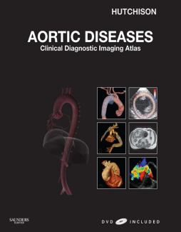 Aortic Diseases E-Book Aortic Diseases E-Book
