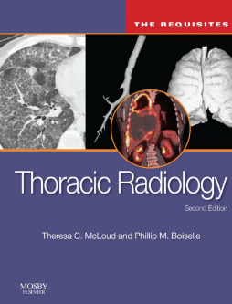 Thoracic Radiology: The Requisites E-Book Thoracic Radiology: The Requisites E-Book