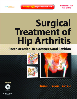 Surgical Treatment of Hip Arthritis: Reconstruction, Replacement, and Revision E-Book Surgical Treatment of Hip Arthritis: Reconstruction, Replacement, and Revision E-Book