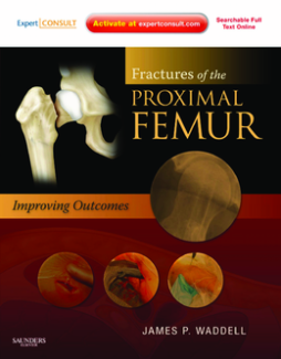 Fractures of the Proximal Femur: Improving Outcomes E-Book