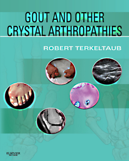 SD - Gout & Other Crystal Arthropathies E-Book SD - Gout & Other Crystal Arthropathies E-Book